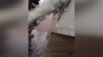 Yüzüne Kimyasal Madde Atılan Kadının Durumu İyiye Gidiyor
