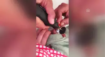 Parmağına Sıkışan Alyansı İtfaiye Çıkardı