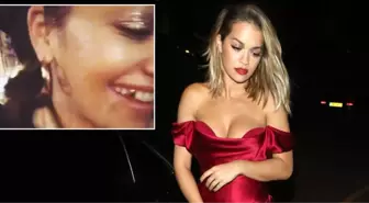 Şarkıcı Rita Ora, Taktırdığı Altın Dişleri Takipçilerine Gösterdi