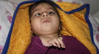 Doğuştan Epilepsi Hastası 3 Yaşındaki Nazlı Yardım Elini Bekliyor