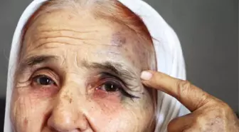 Antalya'da 80 Yaşındaki Kadına Eski Gelininden Sokak Ortasında Dayak İddiası