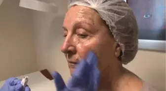 Cilt Gençleştirmede, Lazer Dönemi