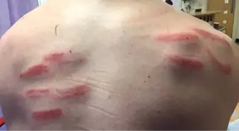 Sırtına Tekme Gelen Kaleci Hastanelik Oldu