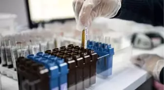 Nadir Hastalıklar Ama Maliyetleri Yüksek