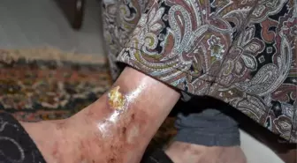 Engelli Raporu Olan Kadının Evde Sağlık Hizmetinden Faydalanamadığı İddiası