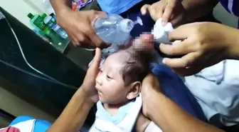 Tek Boynuzla Doğan Bebek, Tıp Tarihine Geçti