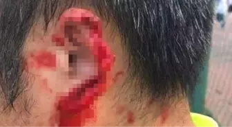 Çin'de Futbolcu Kavga Ettiği Rakibinin Kulağını Isırarak Kopardı