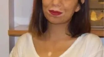 'Vitiligo Hastalık Değildir, Cilt Sanatıdır'