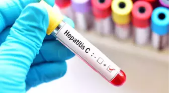 Türkiye'de Her 100 Kişiden 1'i Hepatit C Hastası