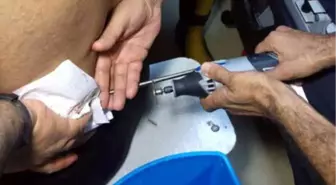 Arkadaşının Balık Avladığı Zıpkının Mili Beline Saplandı