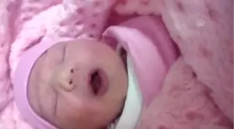 Dokuz Dişli Doğan Bebek Şaşırttı