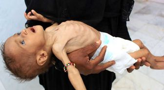 Yemen Krizi: '85 Bin Çocuk Açlıktan Öldü'