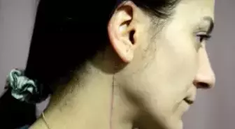 Vücuduna 80 Dikiş Atılan Genç Kadından, Saldırgana 8 Yıl Hapis Cezası İstenmesine Tepki