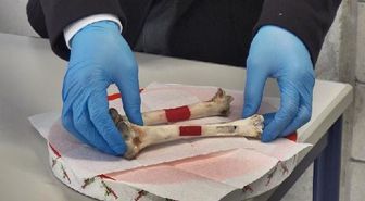 Lületaşı ve Yumurta Kabuğundan Yapay Kemik Dokusu Üretti