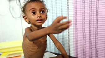 Save The Children: Yemen'de 2019'da 100 Bin Çocuk Koleraya Yakalandı