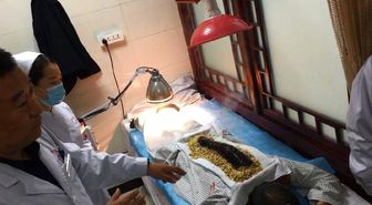 Çin'de 'Ejderha Ateşi' ile İktidarsızlık ve Ağrı Tedavisi