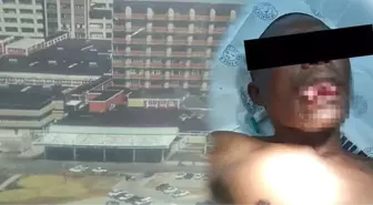 Kadın doktor tecavüzden saldırganının dilini kopararak kurtuldu