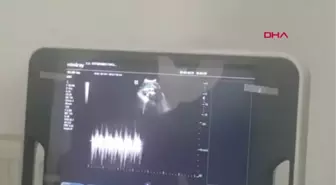 SİVAS HAMİLE KANGAL KÖPEĞİ 'HASKIZ', SEZARYENLE DOĞUM YAPTI