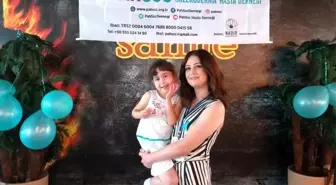 Dünyadaki en küçük skleroderma hastası küçük Mira