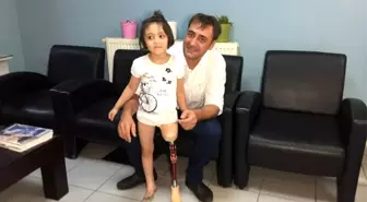 Minik Özge'nin yeni protez bacak mutluluğu