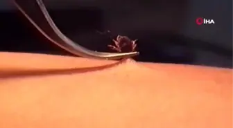 Çorum'da KKKA şüphesiyle 2 kadın tedavi altına alındı