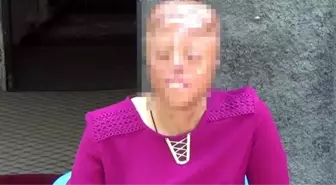 1,5 aylıkken yüzü yanan genç kız, yeni bir yüz istiyor