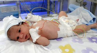 36 günlük Asel bebek için ailesi Cumhurbaşkanı Erdoğan'dan yardım istedi
