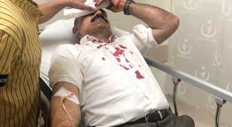Sendika başkanına muştalı saldırı
