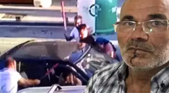 Öfkeli damat, kayınpederinin dudağını ısırarak parçaladı