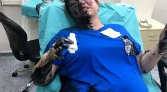 İş kadınını darp edip, yanıcı madde döken zanlı tutuklandı