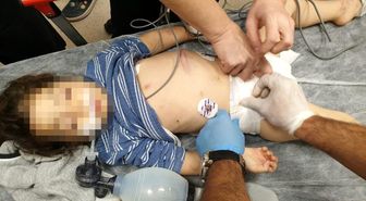 Üvey annenin komaya soktuğu küçük kıza devlet sahip çıktı