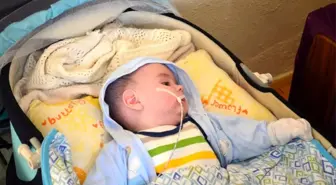 Şizensefali hastası bebeğin ailesi yardım bekliyor