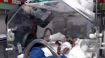 Van'da 490 gramlık bebeğin tedavisi sürüyor