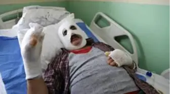 'Köyü yangından kurtarayım' derken canından oluyordu