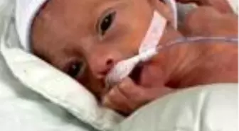 İsveçli bebek Alicia'nın tedavisi, Akdeniz Üniversitesi'nde yapılacak