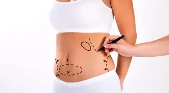 'liposuction' hakkında bilmeniz gerekenler!