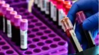 İngiliz araştırmacılar üç tip koronavirüsü incelediler: Enfeksiyonlar ilkbaharda durma noktasına geliyor