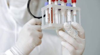 Virülans nedir? Virülans anlamı nedir? Virülans ne demek?