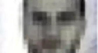 Bekçiye sopayla saldıran zanlı vurularak yakalandı