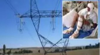 Elektrik akımına kapılan 13 yaşındaki çocuğun ayak tabanları patladı