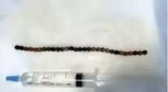 Şiddetli ağrı şikayetiyle hastaneye giden adamın cinsel organından 29 adet bilye çıktı