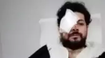Silahlı kavgada gözünü kaybeden genç şarkıcı dehşet anlarını anlattı: Saatlerce acı çektim