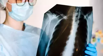 KOAH hastalığında fazla kiloları vermek idrar kaçırma şiddetini azaltıyor