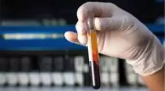 İngiltere'de 50'den fazla kanser türünü erken tespit etmesi umulan kan testi denenecek