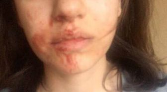 Annesiyle kendisini darbeden ağabeyi serbest kalan genç kız: Bizi ölümle tehdit ediyor