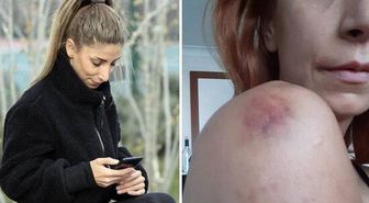 Sevgili şiddeti genç kadını canından bezdirdi: İşkence, sadistlik boyutundaydı