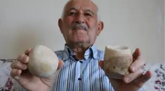 Mesanesinden 2 kilo taş çıkan 73 yaşındaki kişi; Bu taşları ömür boyu saklayacağım