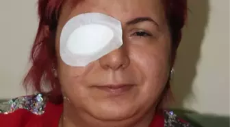 Alerji olan kadının derisi döküldü, sağ gözü görme kaybı yaşadı