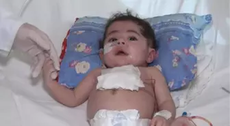 DÜNYADA 33, TÜRKİYE'DE 2'NCİ VAKA...  5 AYLIK IRAKLI BEBEĞİN KALBİNE TÜRK DOKTORDAN ZIRH...