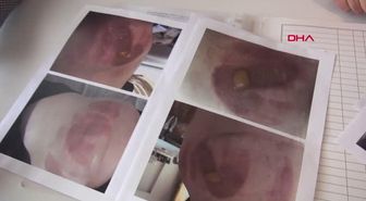 İZMİR Estetik mağduru Mansuroğlu Kadınlar, yeterlilik belgesi olmayan yerlere gitmesin